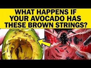 🥑 AVOCADO with Brown Stringy Fibers — Is It Safe to Eat? The Truth Will Shock You!