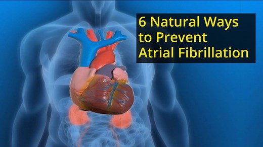 6 Natural Ways to Prevent or Reverse Atrial Fibrillation