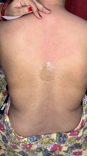 Different hair directions back Waxing mathod/ Full back waxing by Gel wax/ #Backwaxing #gelwax #wax