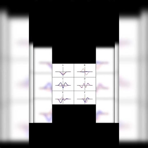 Wave Function Conditions for CSIR NET#csirnet #quantummechanics #mscphysics#physicsnotes#studyshorts
