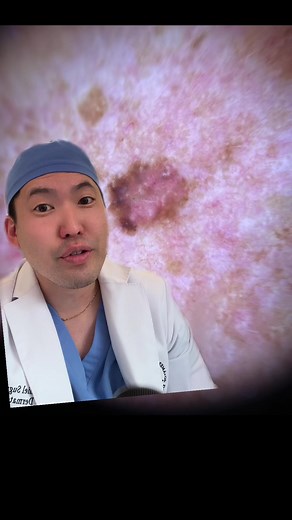 Understanding Dermatoscopes for Skin Exams