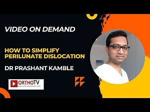 How to Simplify Perilunate dislocation - Dr Prashant Kamble