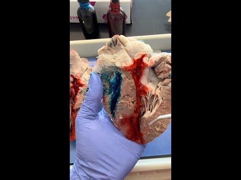 Sheep Heart Dissection (Part 3 of 3): Internal Structures