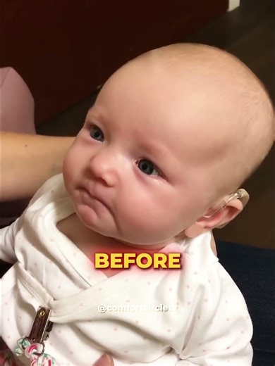 This Deaf Baby's Smile Is Priceless...😭💖