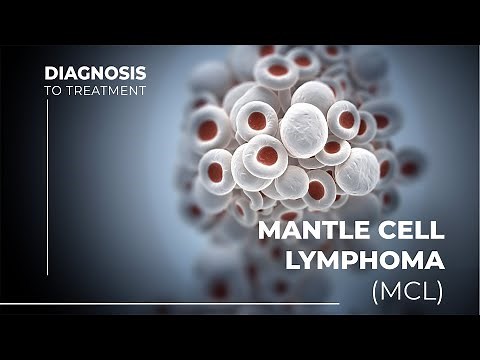 Understanding Mantle Cell Lymphoma: Symptoms, Causes, and Treatment Options