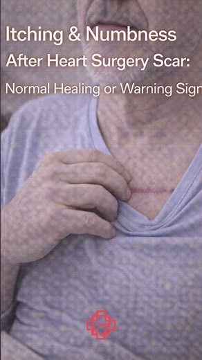 Heart Surgery Scar Itching & Numbness ⚠️ Normal Healing or Not? Dr. Aliasgar Bahrainwala