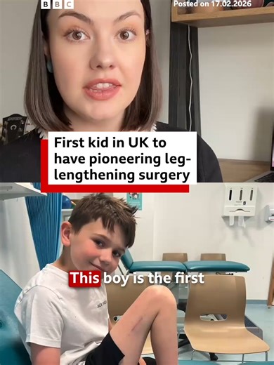 Alfie has a rare condition called fibular hemimelia, which caused his right leg to not develop properly. #Surgery #Hospital #Liverpool #BBCNews