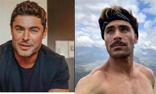 ¿Qué le pasó? Esta es la verdadera razón detrás del nuevo rostro de Zac Efron