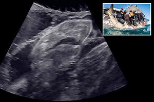 Pregnancy scan shows tiny baby shark wriggling around INSIDE the womb