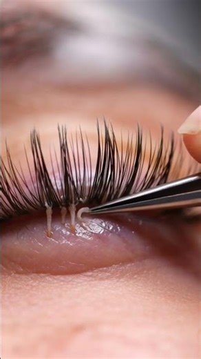 Oddly satisfying video of Demodex mites being removed from eyelashes. #weirdstuff #demodex