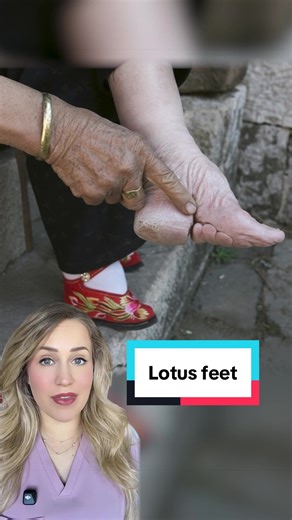 Exploring the Significance of Lotus Feet and Foot Binding