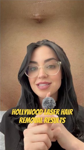 Hollywood (Full Bikini) Laser Hair Removal Results