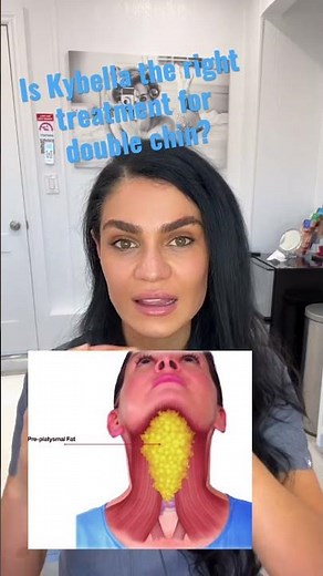 Kybella for double chin treatment is not for everybody!!! Are you a good candidate?