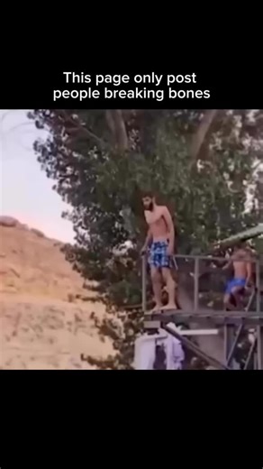 People Breaking Bones on Instagram: "Follow @pplbreakingbone for more 🦴 Broken bones, or fractures, happen when a force greater than the bone’s strength is applied — causing it to crack, shatter, or completely snap. It can occur from falls, direct impacts, accidents, or even repetitive stress over time. The severity can range from small hairline fractures to complex breaks where the bone splits in multiple directions. The moment it happens, the pain is usually sharp and intense, often accompani