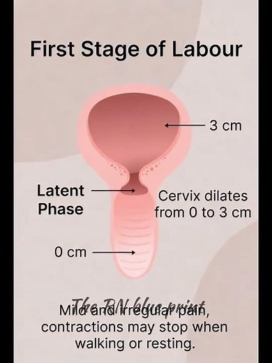 “First Stage of Labour Explained: What to Expect from Early Contractions to Active Labour”