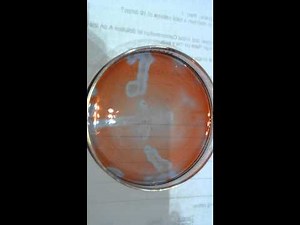 Belousov-Zhabotinsky (BZ) Reaction