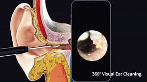 Ear Wax Removal Tool - Ear Camera with 360° Visual Ear Cleaning Kit - 6 Silicone Covers - Ear Wax Removal Kit - Ear Wax Cleaner Earwax Removal Kit White