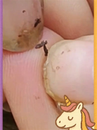 Find Lice 270 #omg #lice #tripofobia #liceremoval #licetreatment