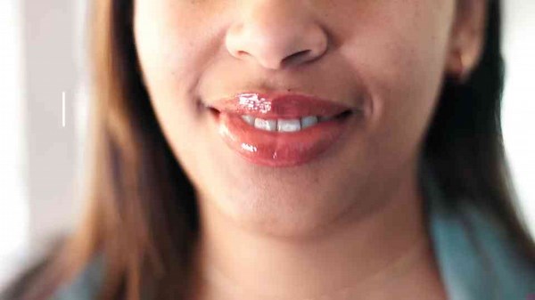 Do you need antibiotics before dental work if you have a joint replacement?