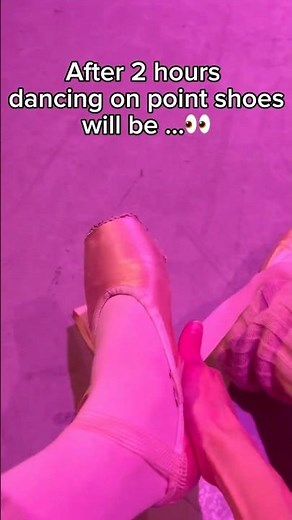 How ballerina feet look like… 😳 #ballet #feet #dancer #bunions #ballerina #ballerinafeet