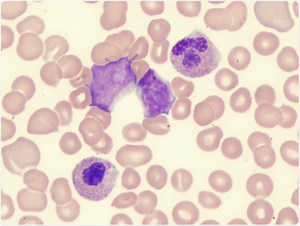 What are Myelodysplastic Syndromes?