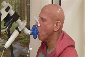 Healthy Living: New Therapy for Scleroderma