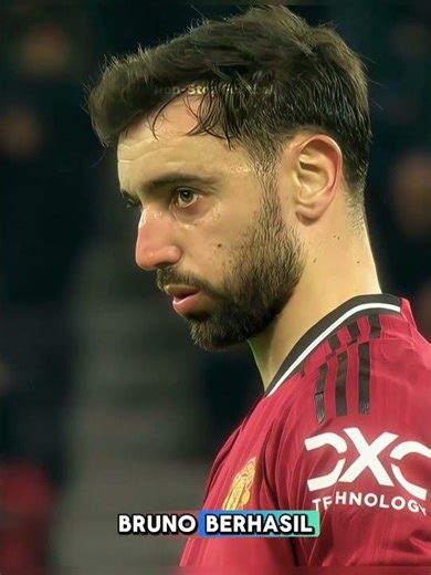 Bruno takes revenge in a classy way😎