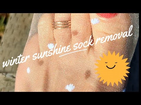🌞winter sunshine sock removal #beautifulfeet