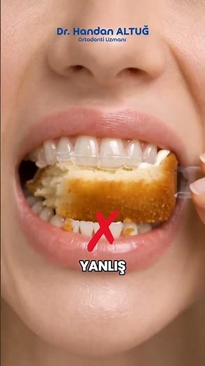 Şeffaf Plak Kullanımında Doğru Ve Yanlışlar Nedir? I #ağızvedişsağlığı #DişFırçalama #dişbakımı