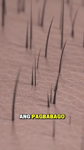 This is not just about hair- it's about confidence, growth, and a fresh start. 💪 If you've been thinking about hair restoration, maybe it's time to take that first step. 💬Comment "𝐘𝐄𝐒" if you want to see more real transformations" | GraftLab Hair Philippines