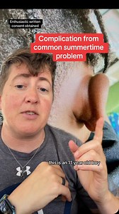 835K views · 9.6K reactions | This is an uncommon complication of swimmers ear or otitis externa, which are common during summer. This retroauricular abscess was drained and the patient is doing well! #ear #infection #case #doctor #ent @drnozebest Disclaimer: For educational and entertainment purposes only and should not be regarded as medical advice or replace the advice of your physician | Dr.Beachgem10 | Facebook