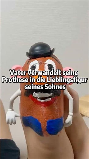 Vater verwandelt seine Prothese in die Lieblingsfigur seines Sohnes ❤️🦿 #Vaterliebe