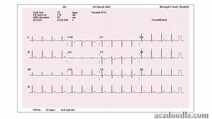 141K views · 2.5K reactions | Bite-sized medical tutorial videos created by experts in the field. Become an ECG guru! | Acadoodle | Facebook