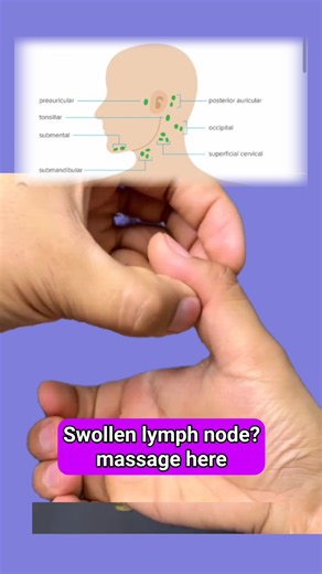 8.6K views · 84 reactions | Swollen lymph node? try this acupressure point massage daily for natural and better result #acupressure #acupointwellness #homeexercise #selfcare #Swollenlymph | Acupoint Wellness | Facebook