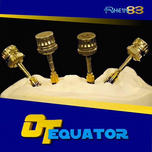 OT Equator attachment: for all implant platforms