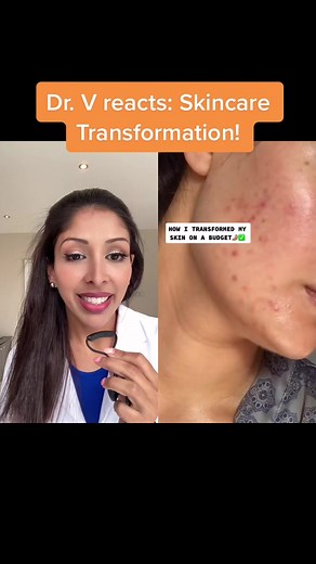 Skincare Transformation Reaction by Dr. V
