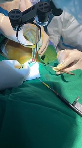 Tracheal Shaving (Adam's apple removal) | KHAI Aesthetic Clinic