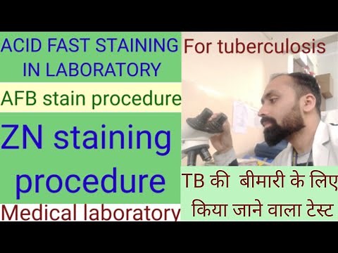 AFB staining procedure / acid fast stain / zn stain for mycobacterium tuberculosis