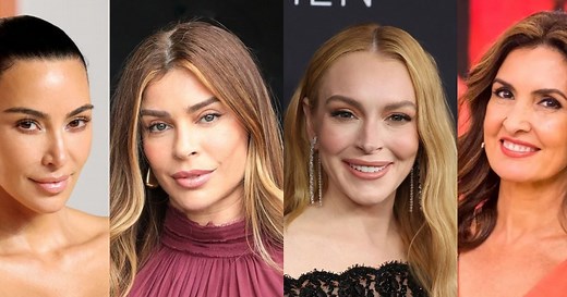 Famosas antes e depois do botox: essas 20 celebridades apostam no procedimento para rejuvenescer o rosto e esconder rugas - e o resultado é impactante