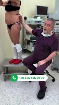 WHAT IS BBL? WHO IS IT FOR? FAT TRANSFER BUTT AUGMENTATION