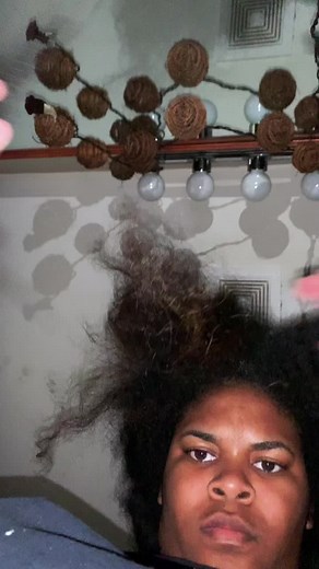 Dandruff Snow: The Hair Dandruff Phenomenon