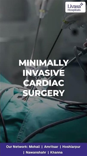 Endovascular Vein Harvesting (EVH) Explained | Dr. Ishant Singla l Livasa Hospitals