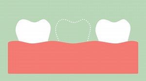 Download missing tooth, space in mouth - dental cartoon vector flat style render 2d footage animation, in 4K and UHD ultra high definition video format 3840x2160 for free