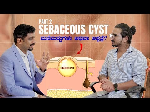 Sebaceous Cyst Treatment EXPLAINED: What Happens After Surgery? part 2