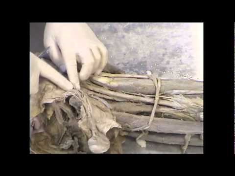 Urinary bladder, prostate and male urethra - Dissection