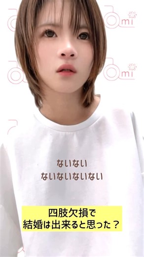 佐野有美 on Instagram: ". . 四肢欠損からの恋愛感 #障害を持っての結婚 #私にとっての恋愛とは #私なりのアンサー #先天性四肢欠損症"