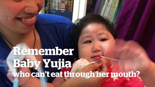 Save Baby Yujia: Yujia was born without part of her oesophagus and cannot swallow her saliva, drink water, or eat. Netizens have helped raise over S$1.2million for her surgery in Boston, but her parents think it might be better to have the surgery in Singapore's KK Women's and Children's Hospital instead, with a doctor from Boston Children’s Hospital consulting the process. Read more: http://tdy.sg/2qM2CrI (Video: Wong Pei Ting/TODAY) | TODAY