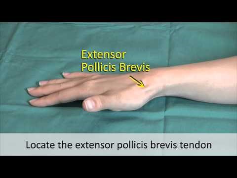 Musculoskeletal Examination and Joint Injection Series_ DeQuervain's Tenosynovitis Injection