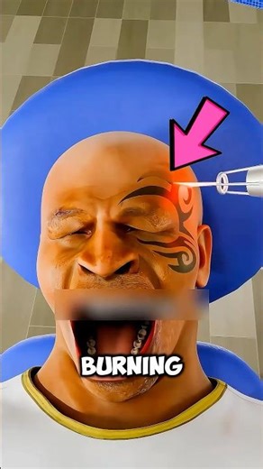 Why Lasers Don’t Actually Burn Tattoos Away⁉️