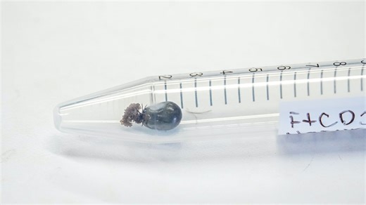 Bit by a tick? What you should know about tick testing and tick removal